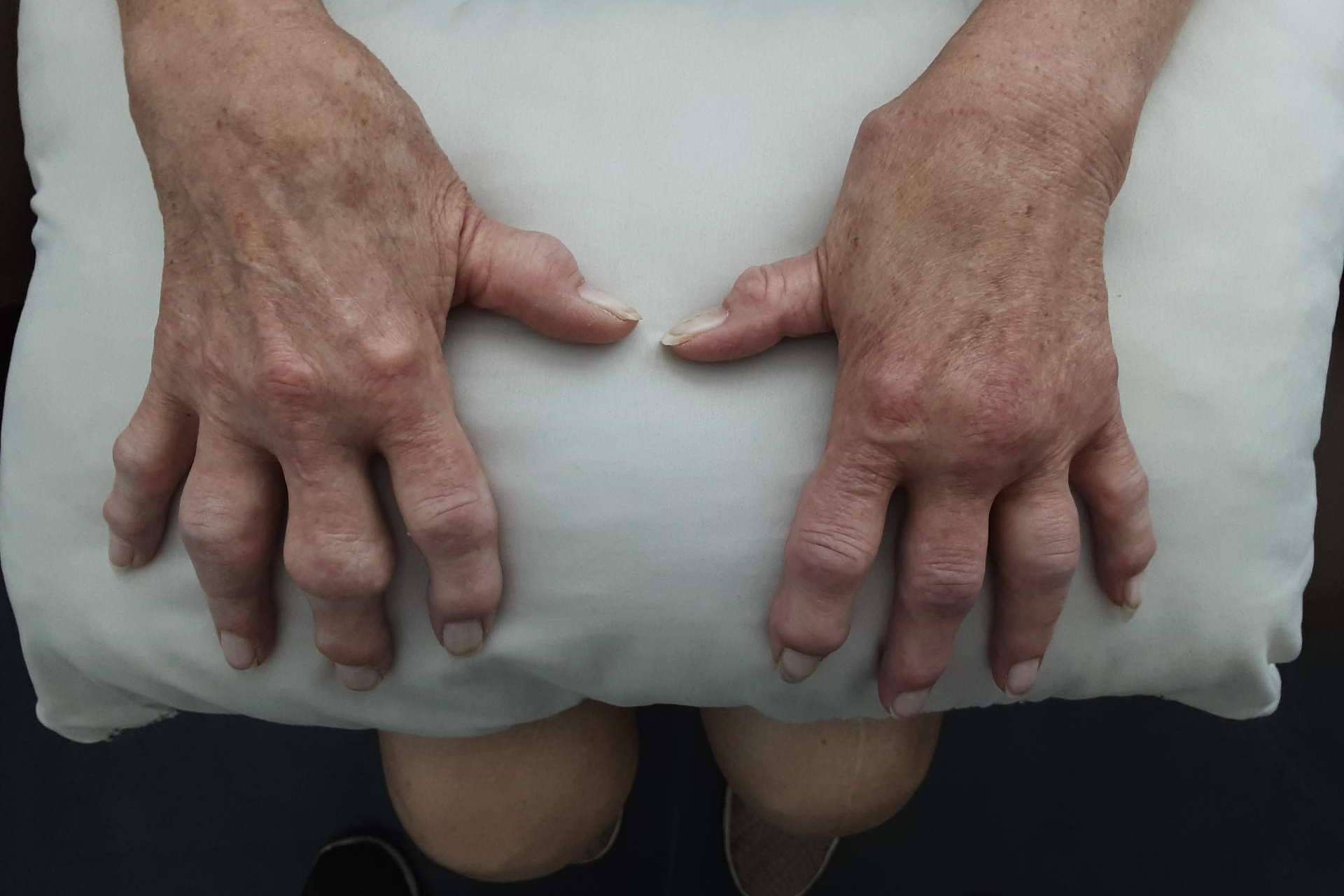 Una clínica especializada en medicina regenerativa, Immunotherapy Regenerative Medicine